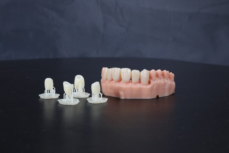 3D printing dental implants