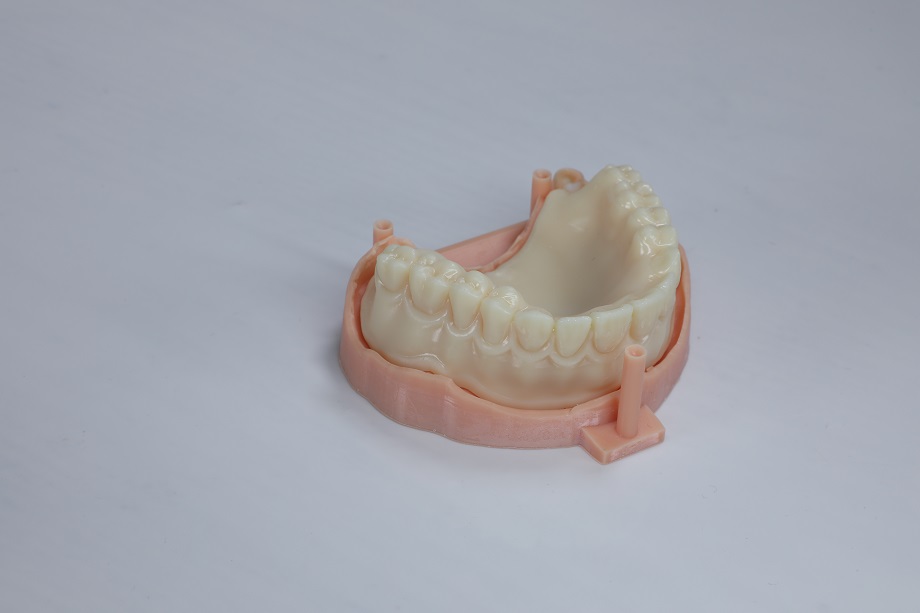 Dental 3D Printing