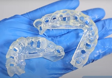 3D Printed Dental Surgical Guides