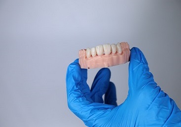 3D Printing Dental Crowns All You Need To Know