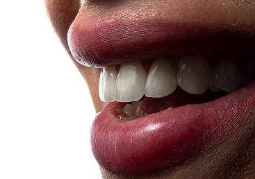 3d printing for orthodontics