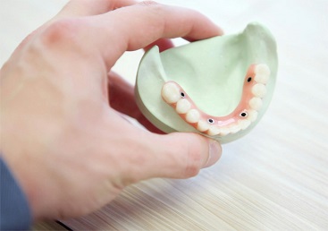 3d printing in dental industry